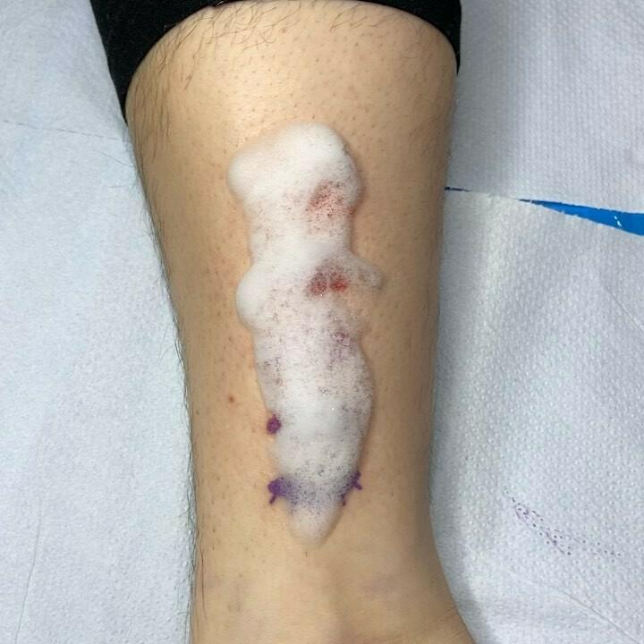 Inksearch tattoo Super Spanko